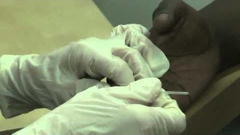 Young person getting tested for HIV Pt 2