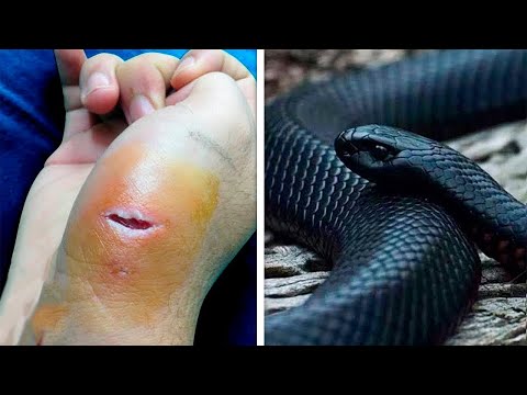 Vídeo: As cobras-liga têm presas?