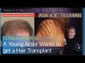 Is This Actor Too Young? Hair Transplant Consultation Ep #2