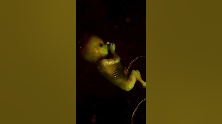 3 Months Unborn baby moving #fetus #pregnancy @TeluguRathnam