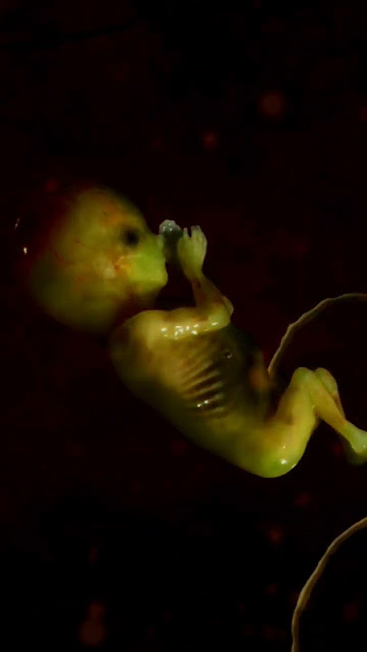 3 Months Unborn baby moving #fetus #pregnancy @TeluguRathnam