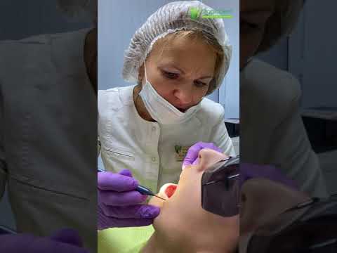 Консультация врача стоматолога в Сочи
