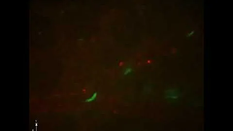Borrelia burgdorferi interacting with blood vessels of the  skin in a live mouse