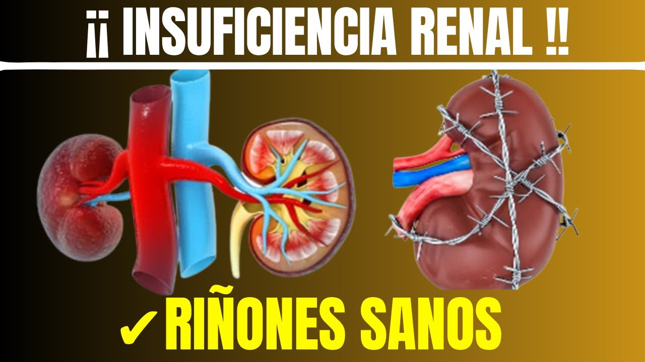 🛑Mantenga Sus Riñones Sanos Y Evite La ¡¡INSUFICIENCIA RENAL!! Con ...