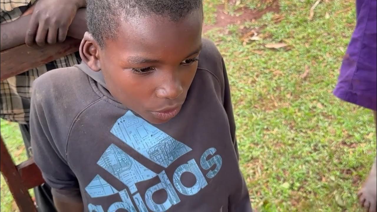 Jigger digging Evans this dude had jigger clusters in a tough skin