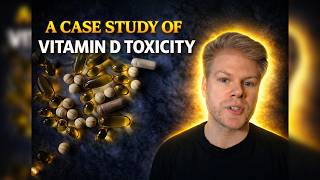 A Case Study Of Vitamin D Toxicity