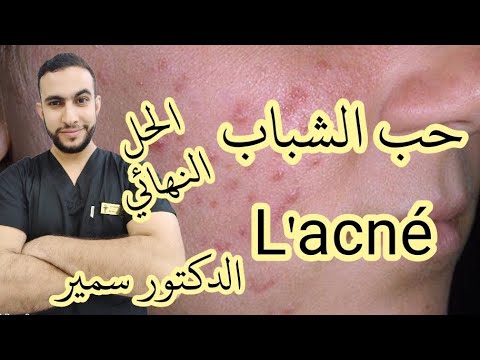    حبوب البشرة و حب الشباب   الحل النهائي