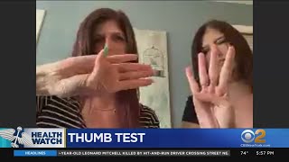 Simple Thumb-Palm Test May Help Detect Likelihood Of Aneurysm