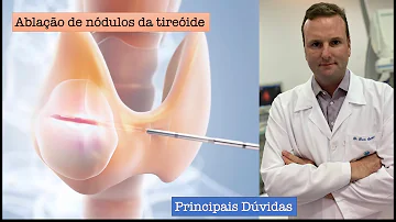 O que é nódulo Hiperecóica?