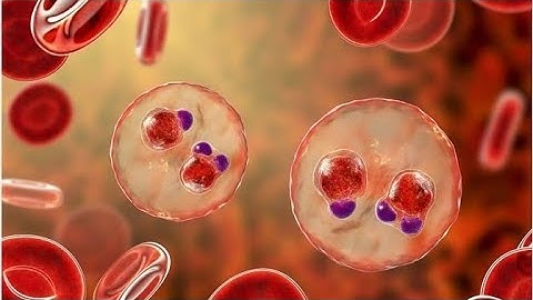 How AI Detects Malaria Faster Than a Microscope