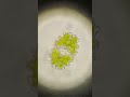 💚 Sieralg - Euastrum bidentatum - 0.052 mm groot - ijsbaan Dalerpeel - 16 mei 2026💚