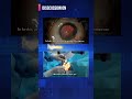 PhacoTips 6.0 – Where Every Surgical Detail Matters