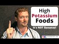 7 Foods High in Potassium (NOT bananas!) - 2020