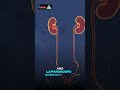 Best Urologist in Ludhiana  | Khosla Stone Kidney &amp; Surgical Centre