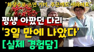 평생 아팠던 다리 '3일 만에 나았다' [실제 경험담]