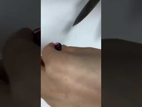 How to remove