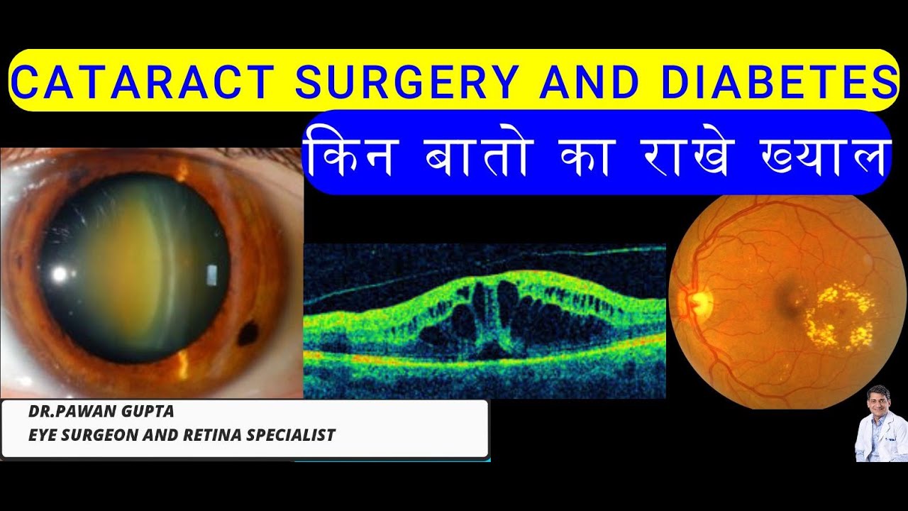 CATARACT SURGERY AND DIABETES: किन बातो का राखे ख्याल ?