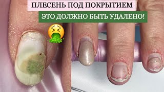 🦠 плесень под покрытием 😟 это должно быть удалено ❌