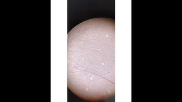 Bsc 2nd year|zoology practical |permanent slides