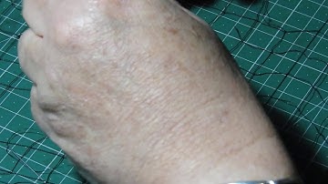 Fixing a 40 year old North Ron Mistnet