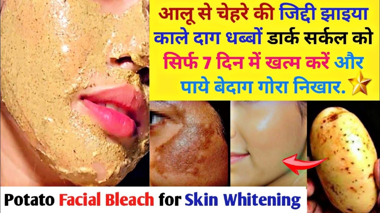 Potato Facial Bleach for Clear and Fair Skin Remove Hyper Pigmentaion