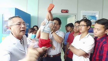 Sơ cứu đúng cách khi trẻ hóc dị vật