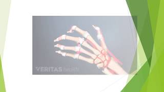 Rheumatoid Arthritis Medications Tips