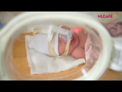 Videó: A 7 hónapos koraszülött?