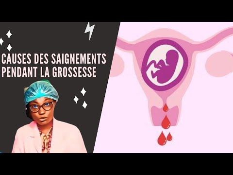 Causes des saignements pendant la grossesse