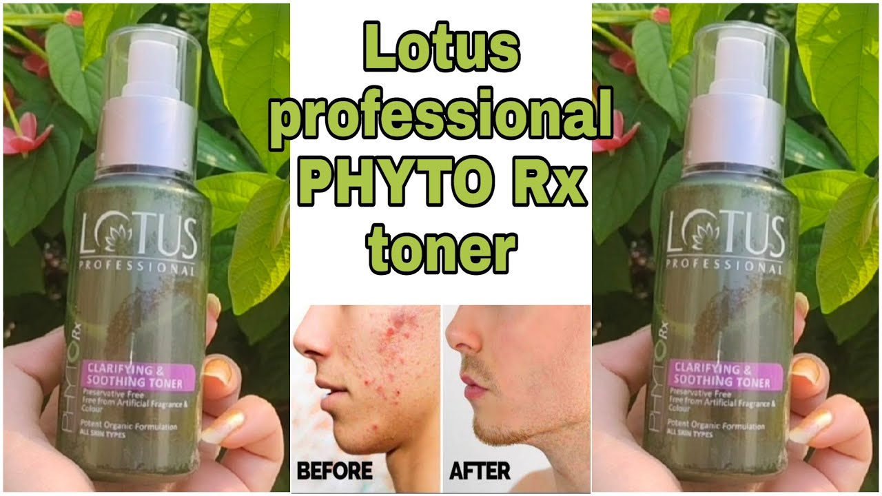 Best Toner For Oily And Acne Prone Skin/ Lotus Professional Phyto Rx Face  Toner - Youtube