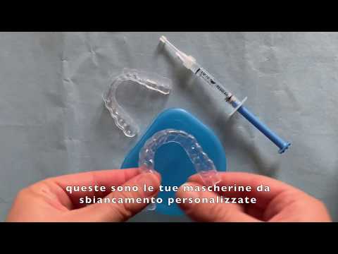 Video: Lo sbiancamento dei denti con opalescenza funziona?