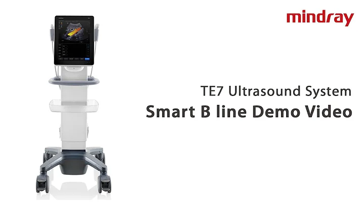 Smart B Line Demo Video in Mindray's Point-of-Care Ultrasound System, TE7 ACE