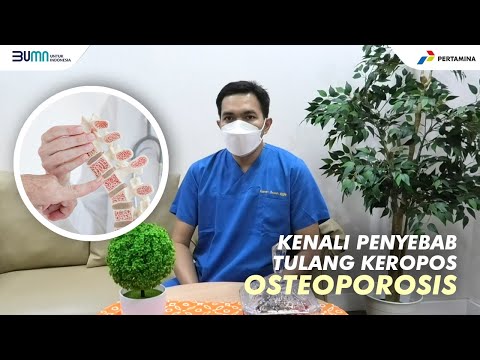 Video: Cara Mengobati Osteopenia: 9 Langkah (dengan Gambar)
