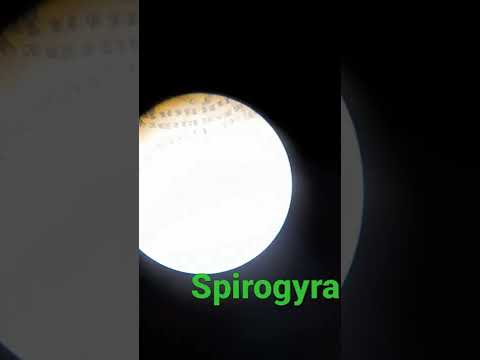 Spirogyra under compound