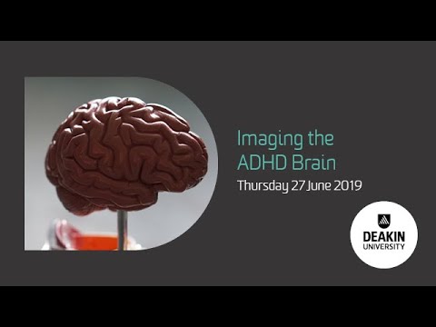 Video: Hüperaktiivsus / Rahutus On Seotud ADHD-ga Täiskasvanute Suurenenud Funktsionaalse ühenduvusega: Puhkeseisundi FMRI Mõõtmete Analüüs