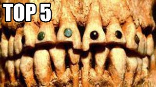 TOP 5 - Odporných zubařských technik historie