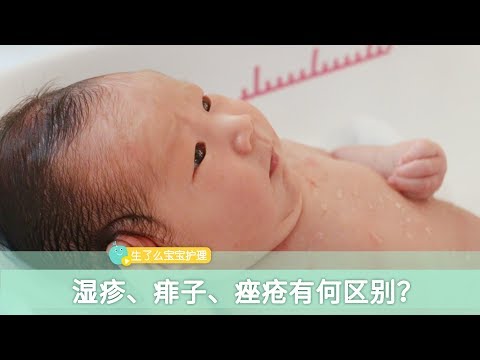 小儿湿疹、宝宝痱子、宝宝痤疮有什么区别？