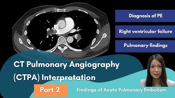Findings of Acute Pulmonary Embolism - CTPA Interpretation Part 2