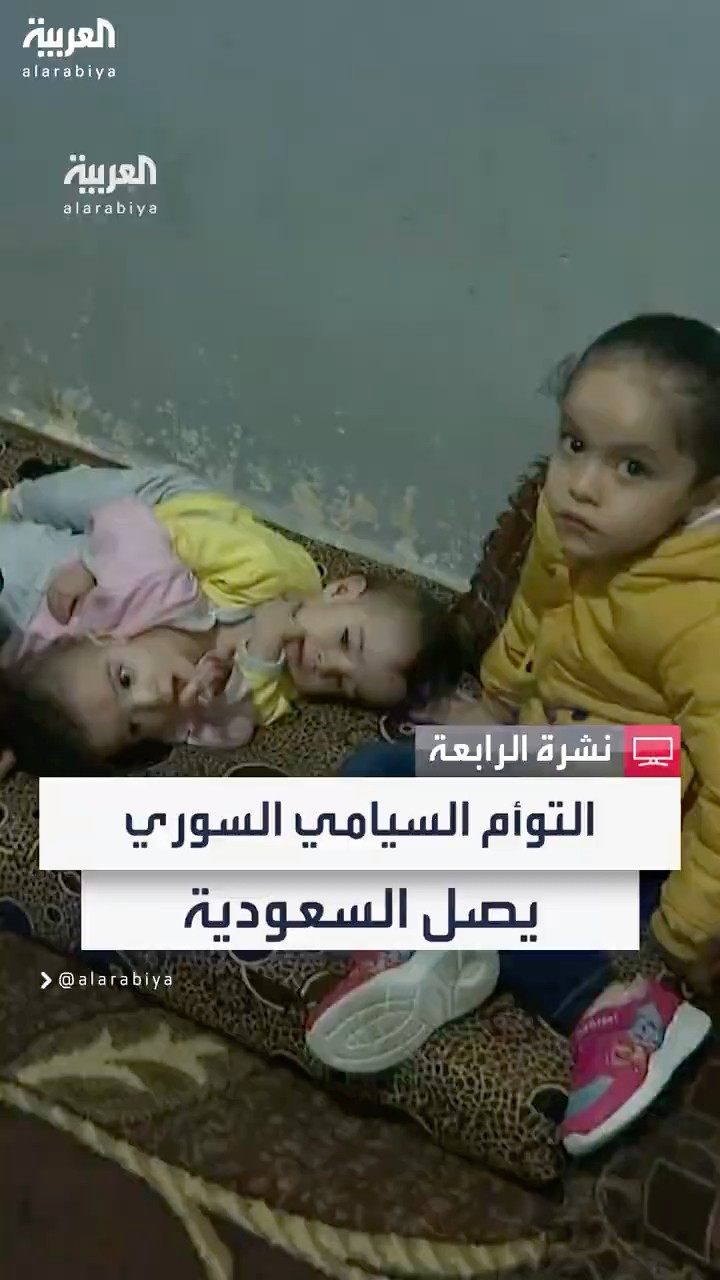 تمهيداً لفصلهما.. التوأم السيامي السوري يصل السعودية قادماً من بيروت