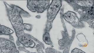 Temple Mumps Outbreak Continues To Grow, According To Officials