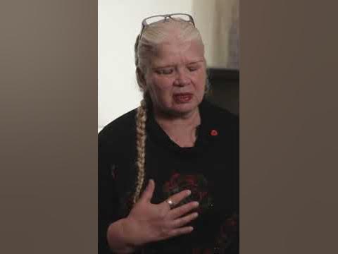Анна перенесла клиническую смерть и онкологию груди - YouTube