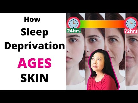 Video: Lack of sleep ages the skin