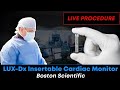 Implanting the LUX-Dx Insertable Cardiac Monitor (ICM), Boston Scientific