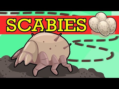 SCABIES, Causes, Signs and Symptoms, Diagnosis and Treatment.