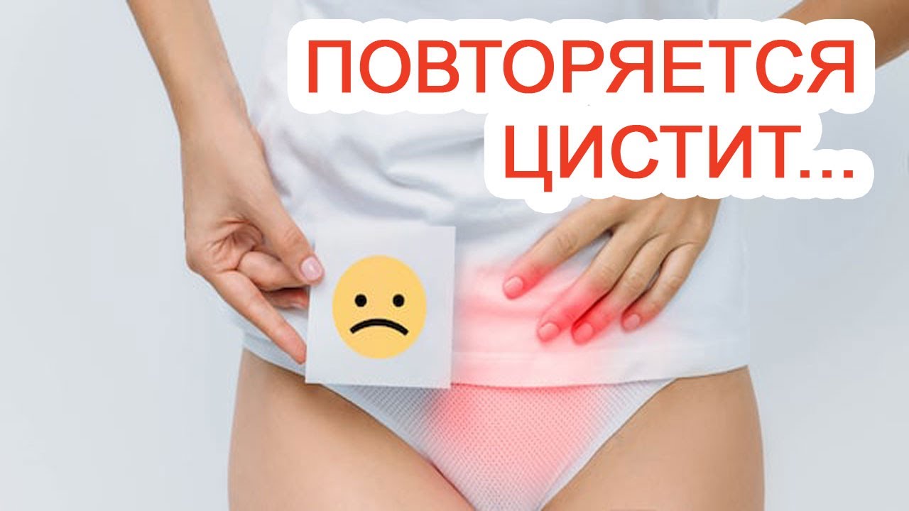 Цистит повторяется. Мочевой доктор.