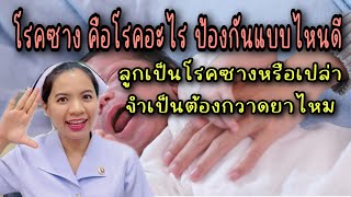 โรคซาง คือโรคอะไร ป้องกันยังไง ลูกเป็นโรคซางหรือเปล่า โรคซางเกิดจากอะไร