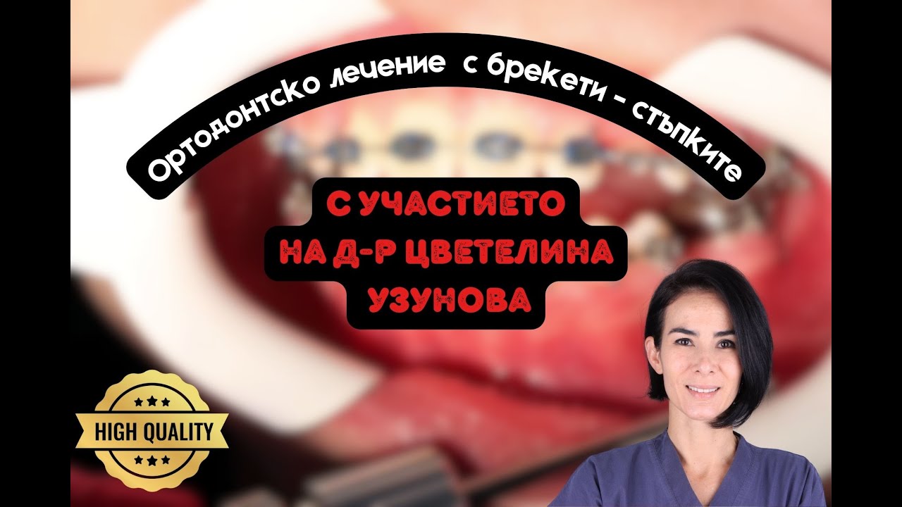 Ортодонт|Лечение|Най-добрият материал за 2025 г.|