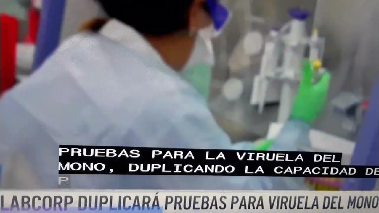 Labcorp duplica pruebas para Viruela del Mono YouTube