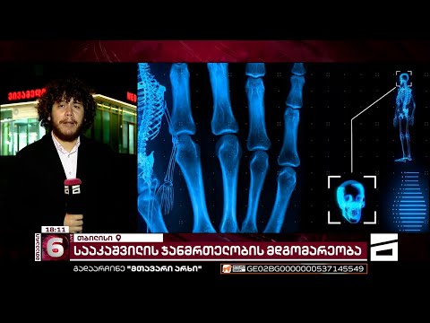 \"აქვს ტემპერატურა, სუსტადაა, ვერ მიიღო საკვები...\" | მიხეილ სააკაშვილის მდგომარეობა ისევ უმძიმესია