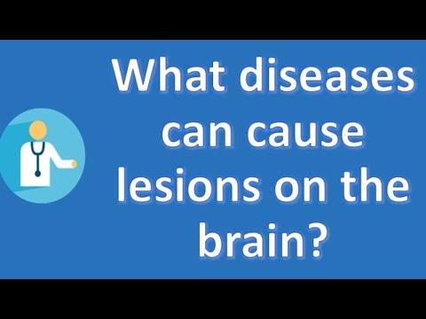 what-diseases-can-cause-lesions-on-the-brain-?-|-most-rated-health-faq-channel